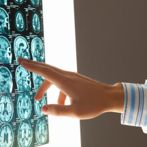 brain injury, legal, personal injury, concussion lawsuit