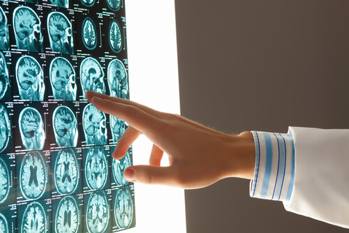 brain injury, legal, personal injury, concussion lawsuit