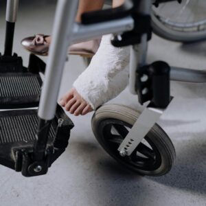 Close-up of an injured foot in a cast resting on a wheelchair, indoors.