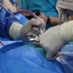 Settlement for a Herniated Disc From a Slip and Fall: Realistic Ranges