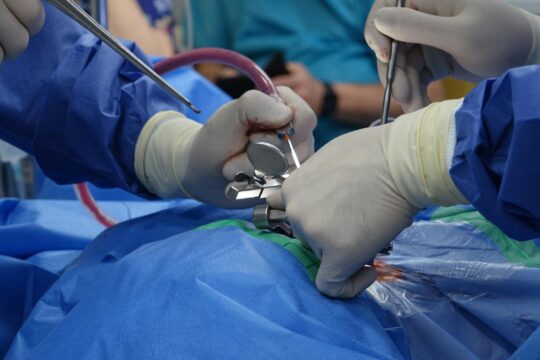 Settlement for a Herniated Disc From a Slip and Fall: Realistic Ranges
