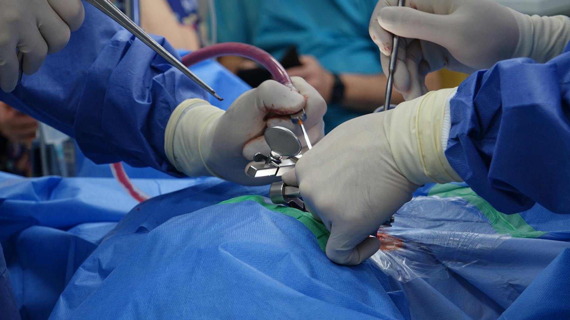 Settlement for a Herniated Disc From a Slip and Fall: Realistic Ranges