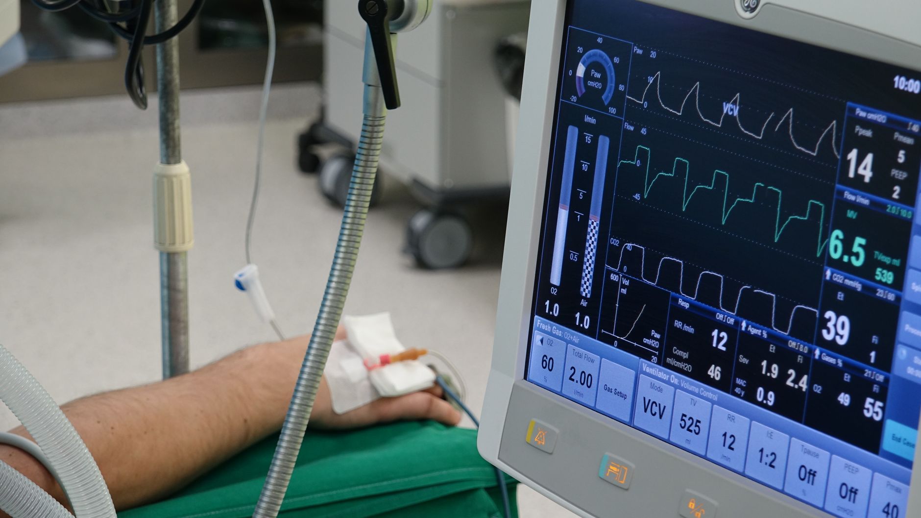 Workplace injury statistics 2026 (A close-up of a patient's hand connected to medical equipment in an ICU room.)